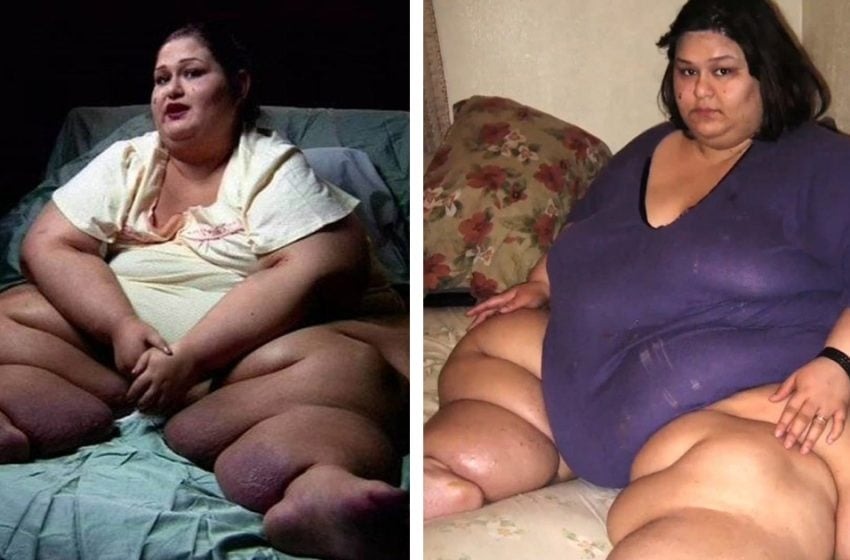  “La vida después de perder peso”. Cómo se ve ahora la mujer, que estaba desesperada por su figura