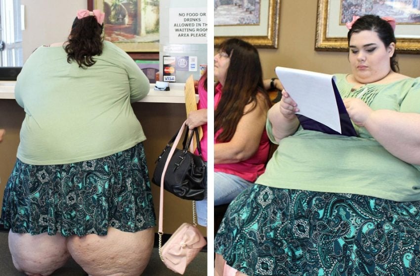  La transformación es increíble: cómo se ve ahora la chica que ha perdido 200 kg