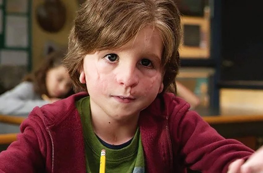  “Sin maquillaje no es reconocible”: cómo luce hoy el actor que interpretó al niño Oggie en la película “Wonder”