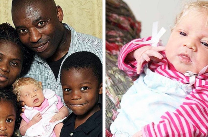  La pareja de piel oscura tuvo una hija albina. ¿Cómo se ve después de 10 años?