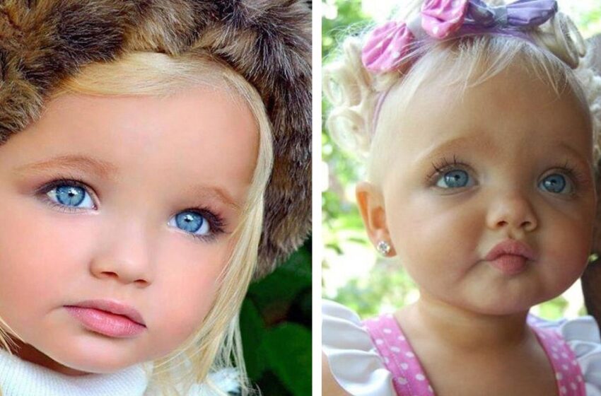 Kom från underlandet: Hur ser flickan, som fick smeknamnet en docka på grund av sitt ovanliga utseende, ut nu
