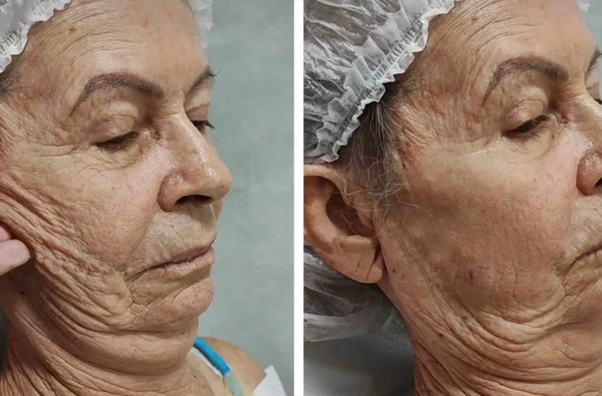  “Hon är oigenkännlig efter plastikkirurgi”: En gammal dam förvandlades till en ung skönhet!